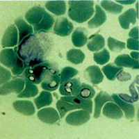 Протозойные инфекции